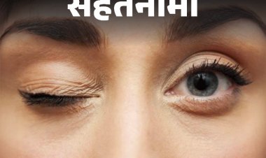 सेहतनामा- आंखों का फड़कना सिर्फ थकान नहीं, हो सकती बीमारी:ब्लेफरोस्पाज्म में आंखों की मसल्स पर कंट्रोल खत्म होता, डॉक्टर से जानें इलाज और बचाव