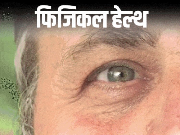फिजिकल हेल्थ- आंखों का साइलेंट किलर है ग्लूकोमा:शुरुआत में नहीं दिखते लक्षण, फिर हो जाता है अंधापन; जानें किसे होता है और कैसे बचें